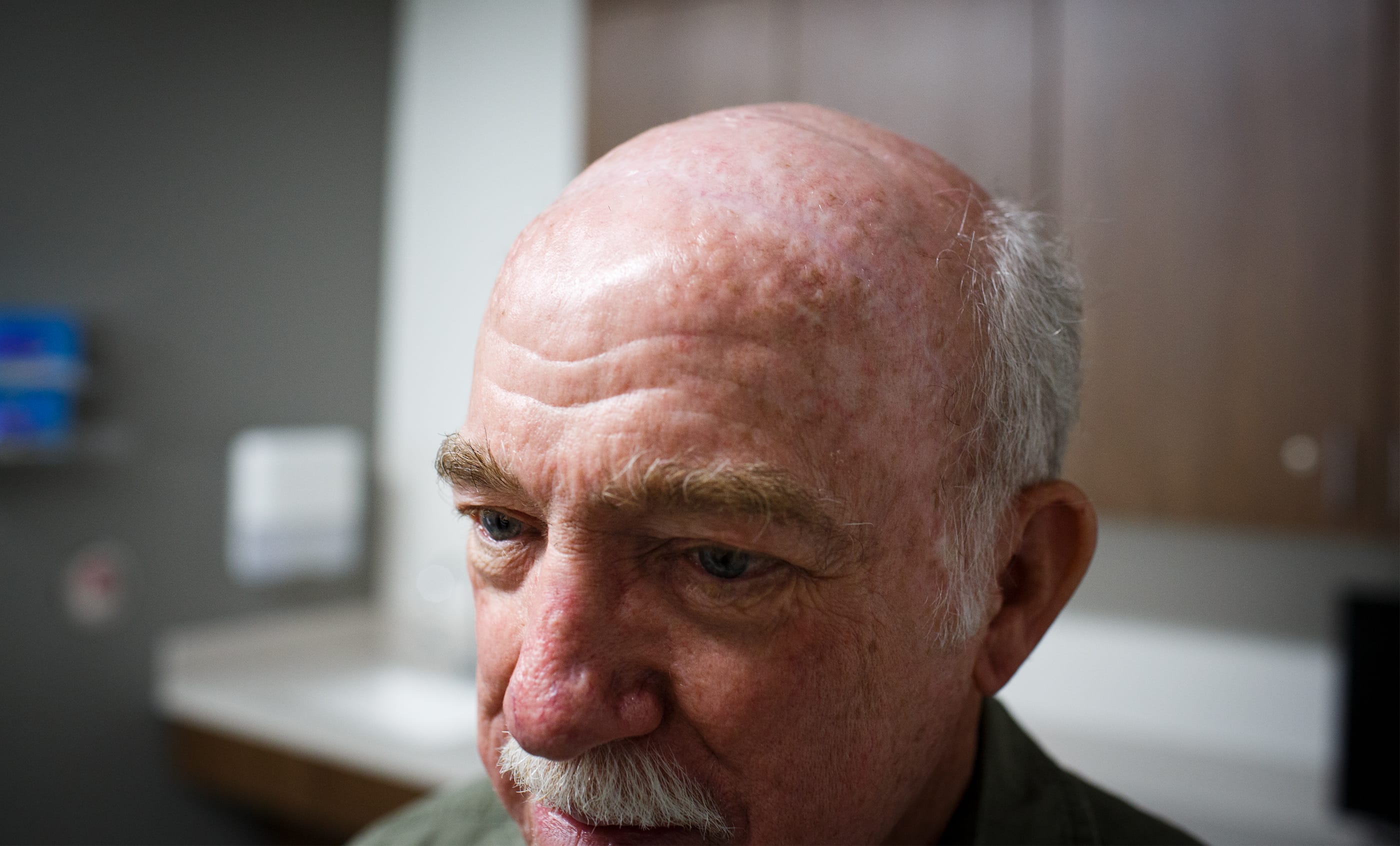 First Patient for ZAP Treatment | ©Toni Greaves Photography
